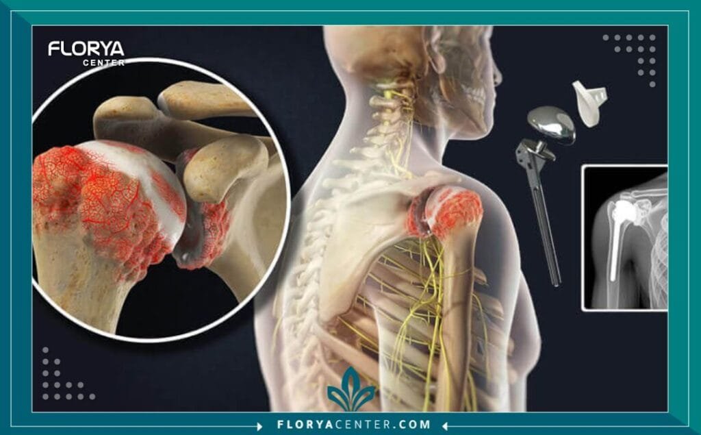 هل فحص «رسم العصب» مؤلم؟ وما الذي يجب أن تعرفه قبل الإجراء؟