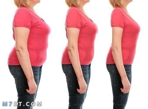 جراحة تكميم المعدة (Gastric Sleeve Surgery):